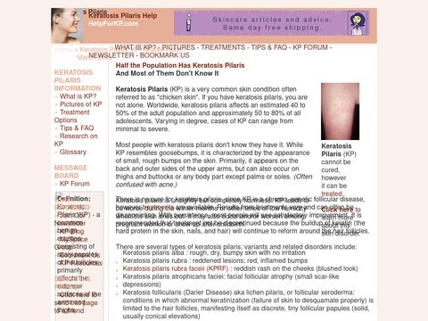 Keratosis Pilaris Help
