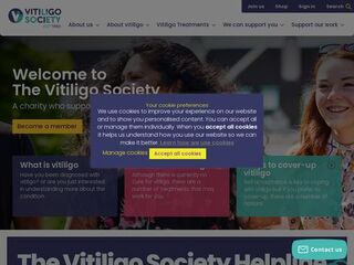 Vitiligo Society UK