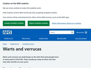 NHS Choices - Warts and Verrucas
