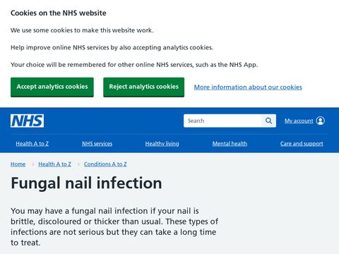 NHS Choices - Fungal Nail Infection