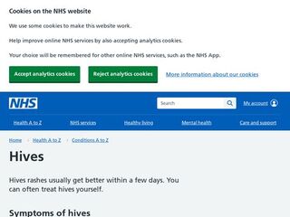 NHS Choices - Urticaria (Hives)