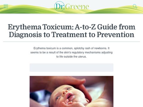 Erythema Toxicum